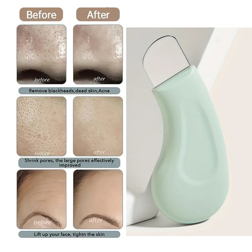 نتائج تنظيف المسام قبل وبعد استخدام الجهاز - Skin pore cleaning results before and after use